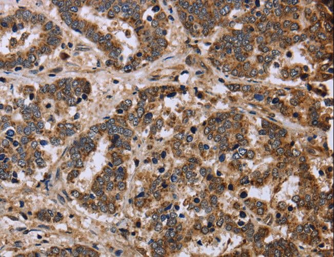 FH / Fumarase / MCL Antibody