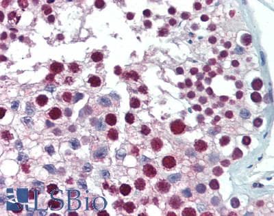 IHC-plus™ FOXP2 Antibody (aa611-623)