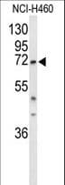 Polyclonal Rabbit anti-Human DDX17 Antibody (aa128-155, IHC, WB)