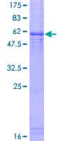 Human FBXO6 Protein (Recombinant GST)