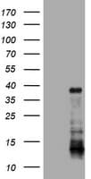 PIK3C2A Antibody (aa230-560, clone OTI3D1)