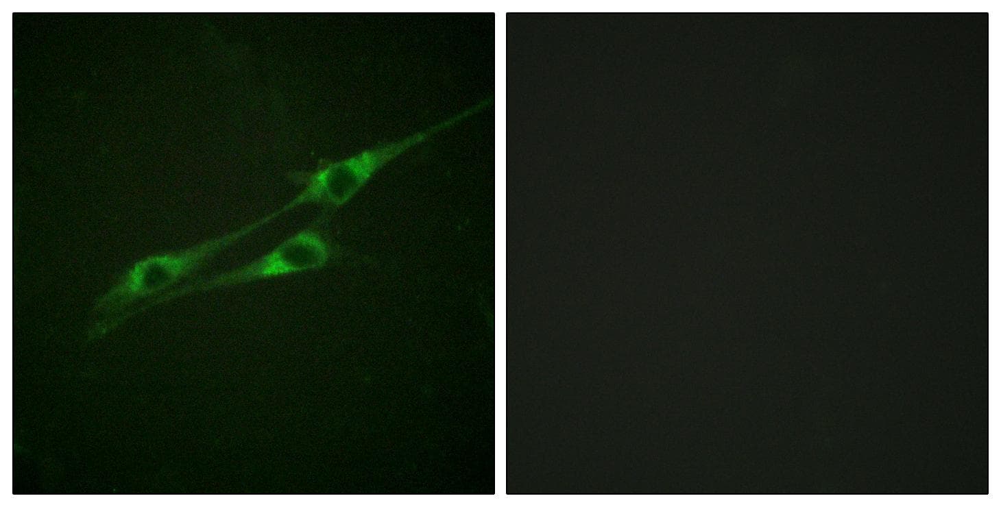 IL13RA1 / IL13R Alpha 1 Antibody (p405)
