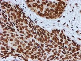 FMR1 / FMRP Antibody (clone OTI3B4)
