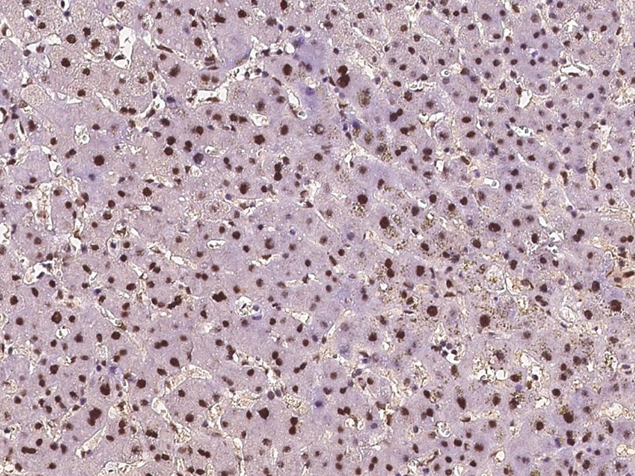 ZDHHC12 Antibody