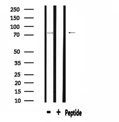 APPL1 / APPL Antibody