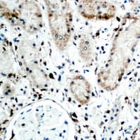 Polyclonal Rabbit anti-Human RBP5 Antibody (N-Terminus, IHC, IF, WB)