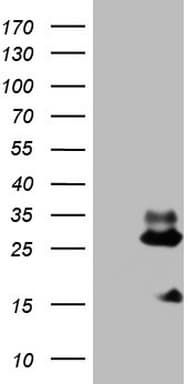 Monoclonal Mouse anti-Human NDUFB11 Antibody (clone OTI5B4, aa30-163, WB)