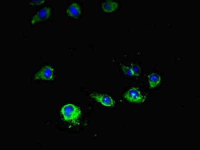 Polyclonal Rabbit anti-Human MTOR Antibody (IHC, IF)