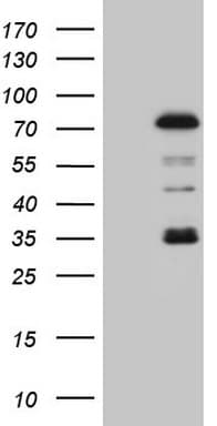PIAS2 / PIASX Antibody (clone OTI2B5)