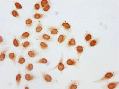 HIST1H2AI Antibody