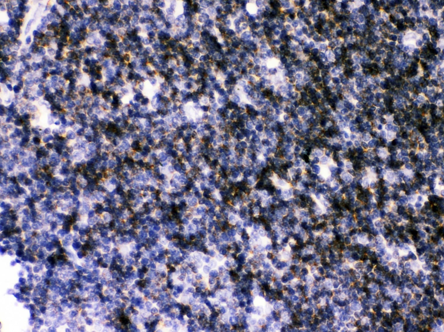 ATP2A3 / SERCA3 Antibody (aa1-30)