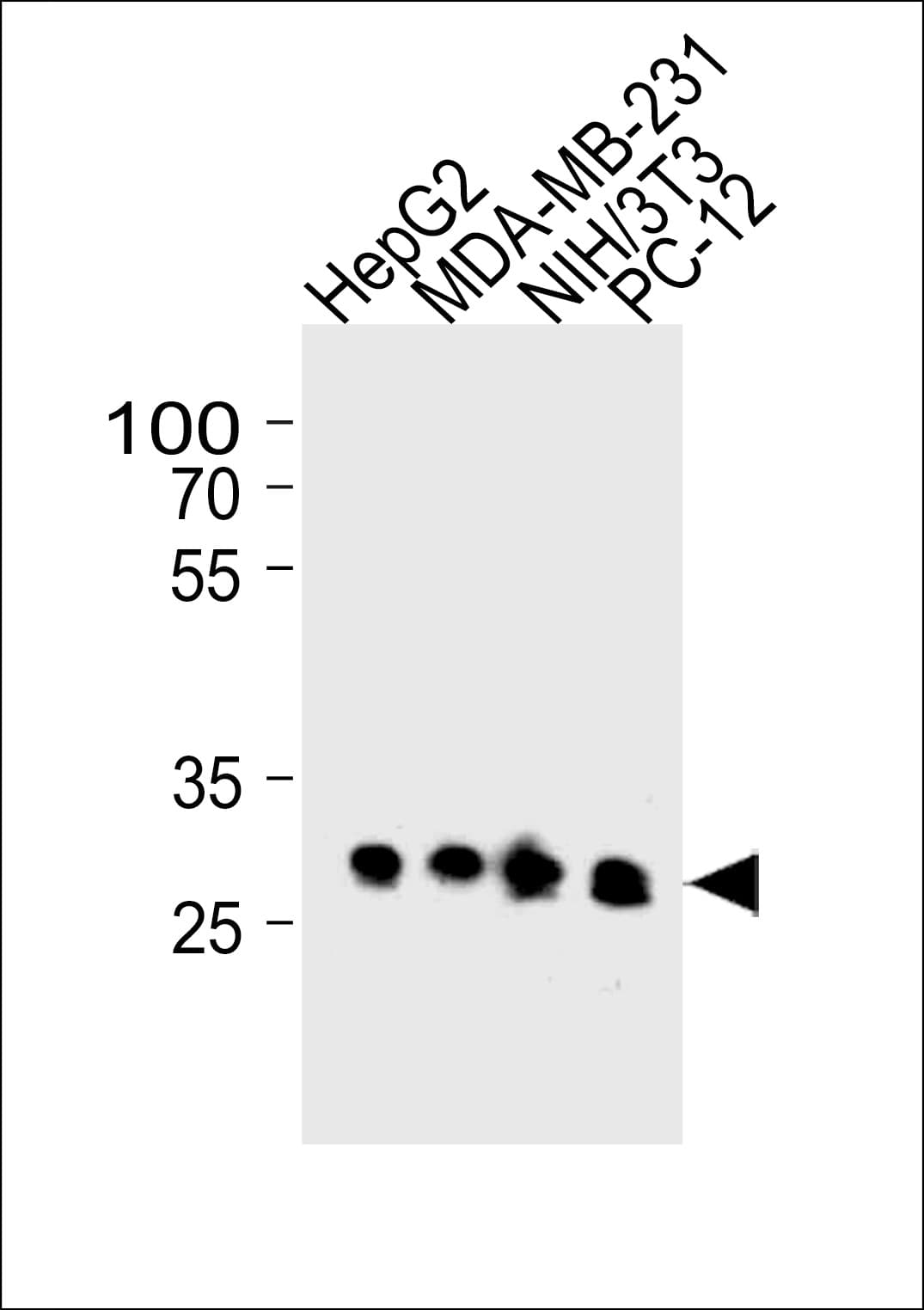 BCL2L1 / BCL-XL Antibody (clone 804CT19.1.4)