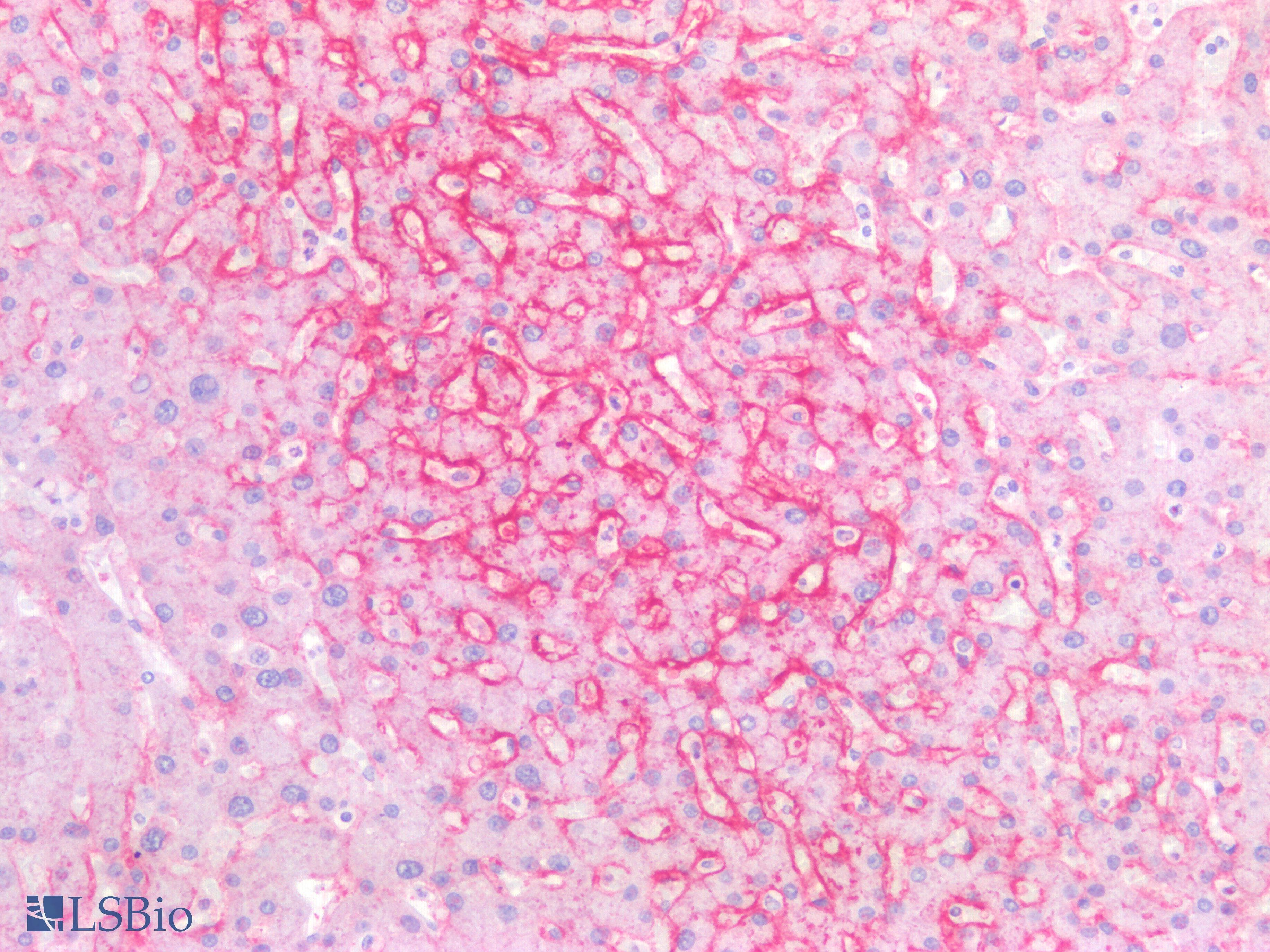PathPlus™ SLC2A2 / GLUT2 Antibody