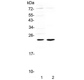 Polyclonal Rabbit anti-Mouse IL6 / Interleukin 6 Antibody (WB)