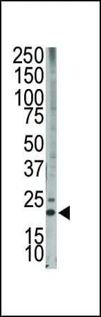 BCL2L11 / BIM Antibody (aa130-165)