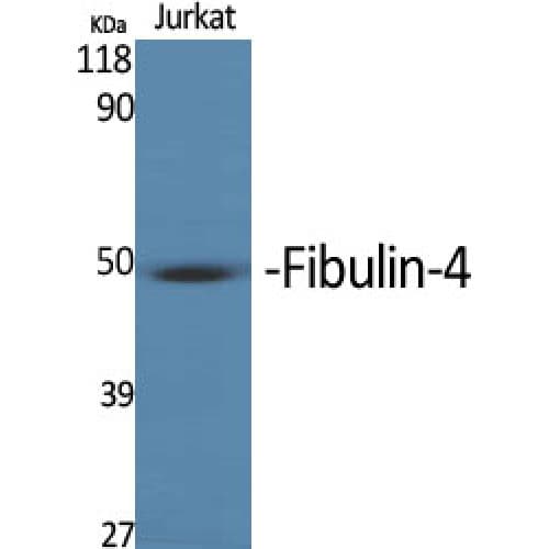 ROX / MNT Antibody (290-370 aa, Internal)