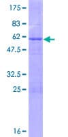 Human PEX11A Protein (Recombinant GST)