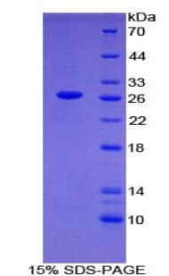 Human NPNT / Nephronectin Protein (Recombinant His-GST)