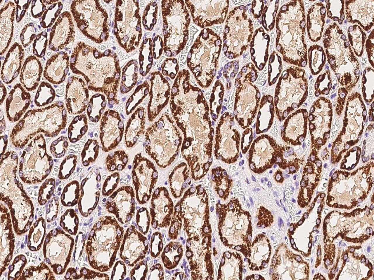 FH / Fumarase / MCL Antibody