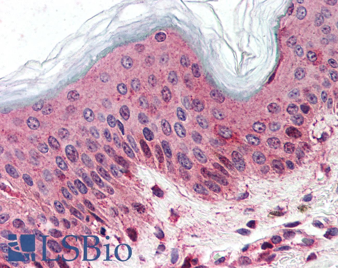 IHC-plus™ SLC5A9 / SGLT4 Antibody (Internal)