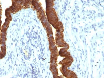 EPCAM Antibody (aa 280-350, clone rEGP40/1110, Azide-free, Carrier-free)