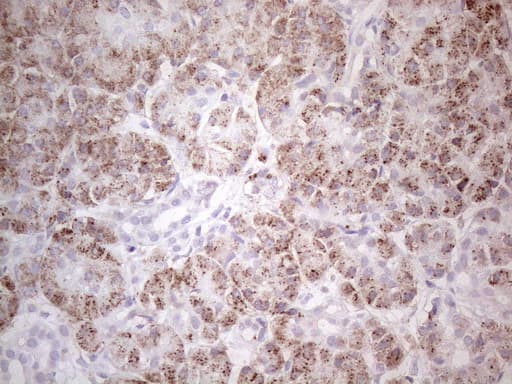 ABAT Antibody (aa29-323, clone UMAB180)