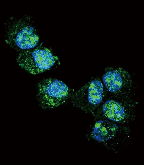 UCHL1 / PGP9.5 Antibody (aa16-46)