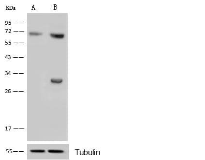 Polyclonal Rabbit anti-Human CDK4 Antibody (Preservative Free, IHC, IF, WB)