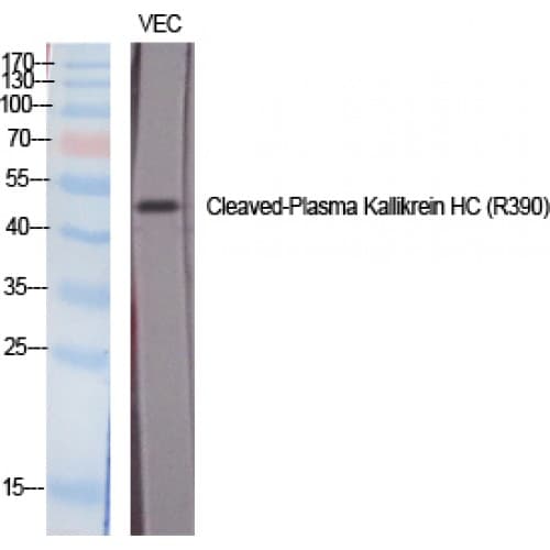 KLKB1 / Plasma Kallikrein Antibody (310-390 aa, Internal)