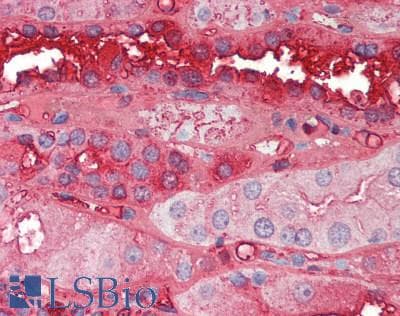 Polyclonal Rabbit anti-Human ALB / Serum Albumin Antibody (IHC, WB)