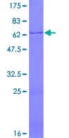Human GMPR2 Protein (Recombinant GST)