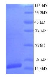 Human HPV18 E7 Protein (Recombinant 6His, N-terminus)