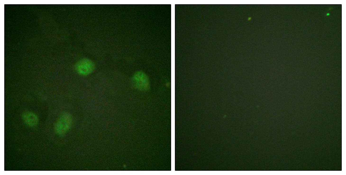 Polyclonal Rabbit anti-Human RAF1 / RAF Antibody (phospho-Ser621, IHC, IF, WB)