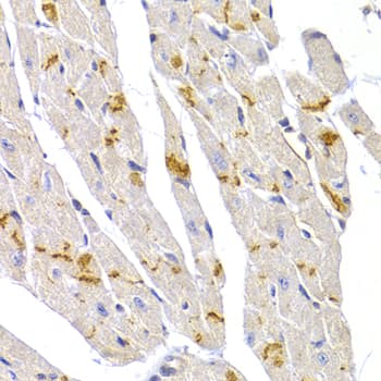 DSP / Desmoplakin Antibody