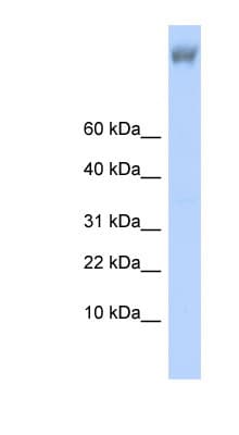 ZNF644 Antibody (aa1223-1272)