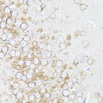 Polyclonal Rabbit anti-Human ARRB1 / Beta Arrestin 1 Antibody (IHC, IF, WB)