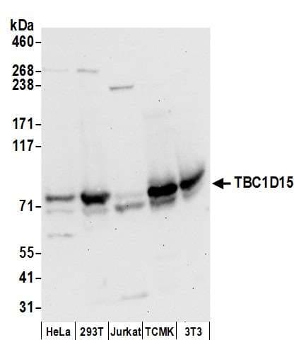 TBC1D15 Antibody (aa1-50)