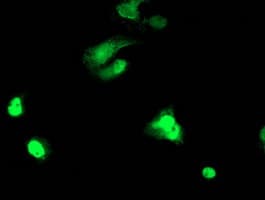 TAL1 Antibody (clone OTI4A6)