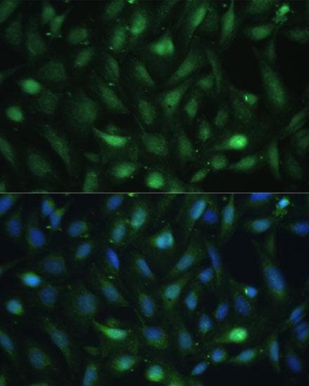 CSNK2B / Phosvitin Antibody