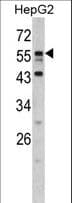 Polyclonal Rabbit anti-Human DONSON / B17 Antibody (aa95-126, WB)