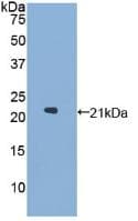 GAA / Alpha-Glucosidase, Acid Antibody (aa595-770)