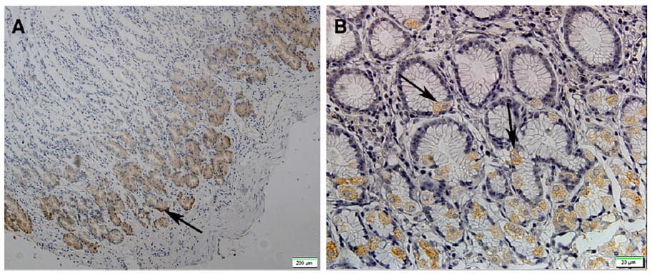 GPR49 / LGR5 Antibody (aa250-550, clone OTI2A2)