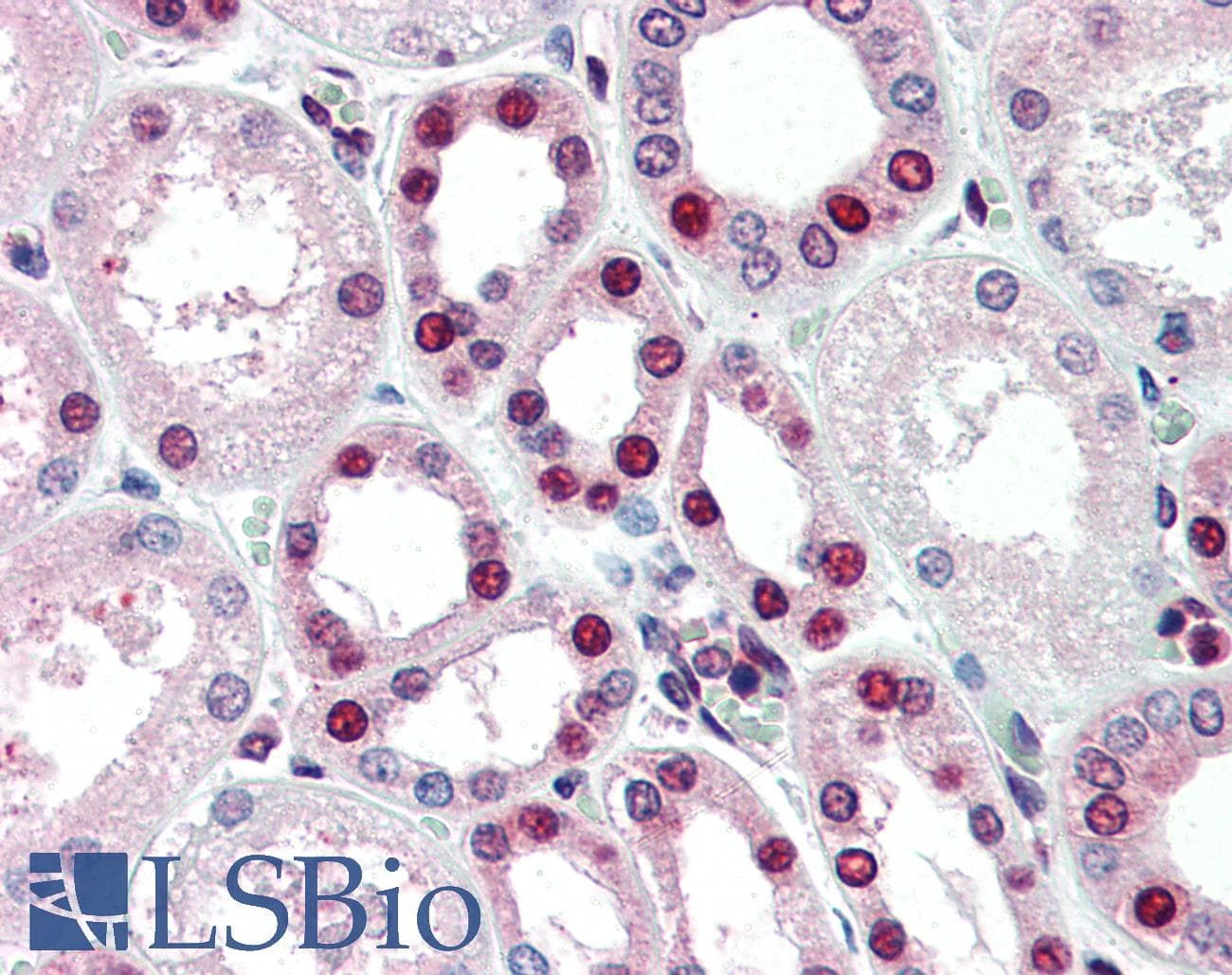 IHC-plus™ PHAP1 / ANP32A Antibody