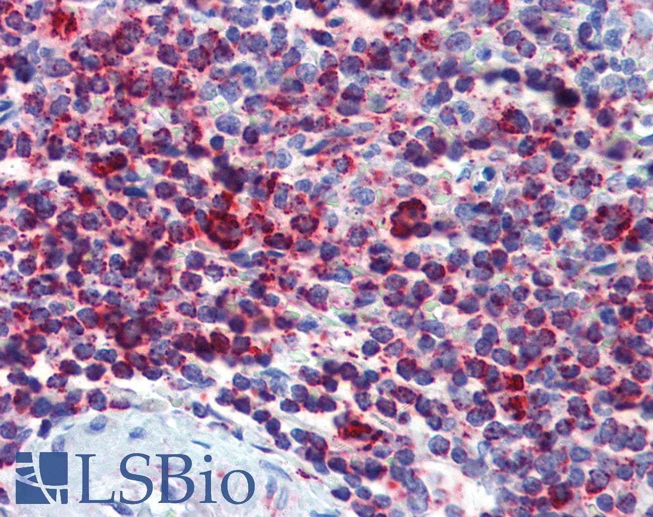 PathPlus™ HSPD1 / HSP60 Antibody (clone LK-2)