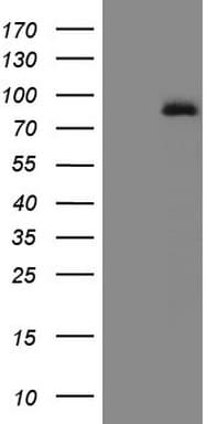 Monoclonal Mouse anti-Human ALOX5 / 5-LOX Antibody (clone OTI3F1, aa18-364, IHC, WB)