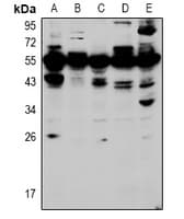HOXA5 Antibody