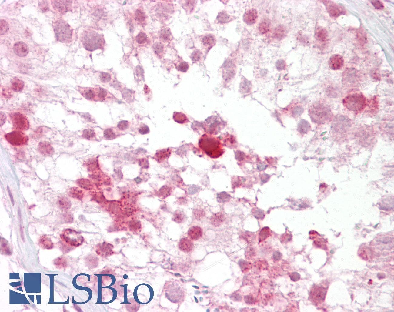 TG737 / IFT88 Antibody (N-Terminus)