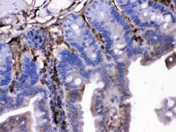 FGF1 / Acidic FGF Antibody
