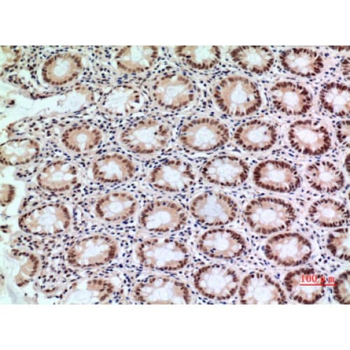 Polyclonal Rabbit anti-Human HIF2A / EPAS1 Antibody (380-420 aa, IHC, IF, WB)