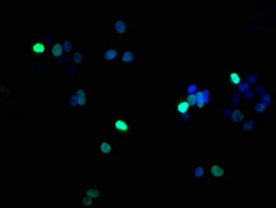 Polyclonal Rabbit anti-Human HIST1H1B Antibody (phospho-Ser17, WB)